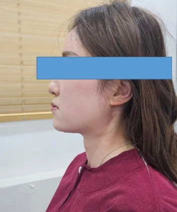 before_image