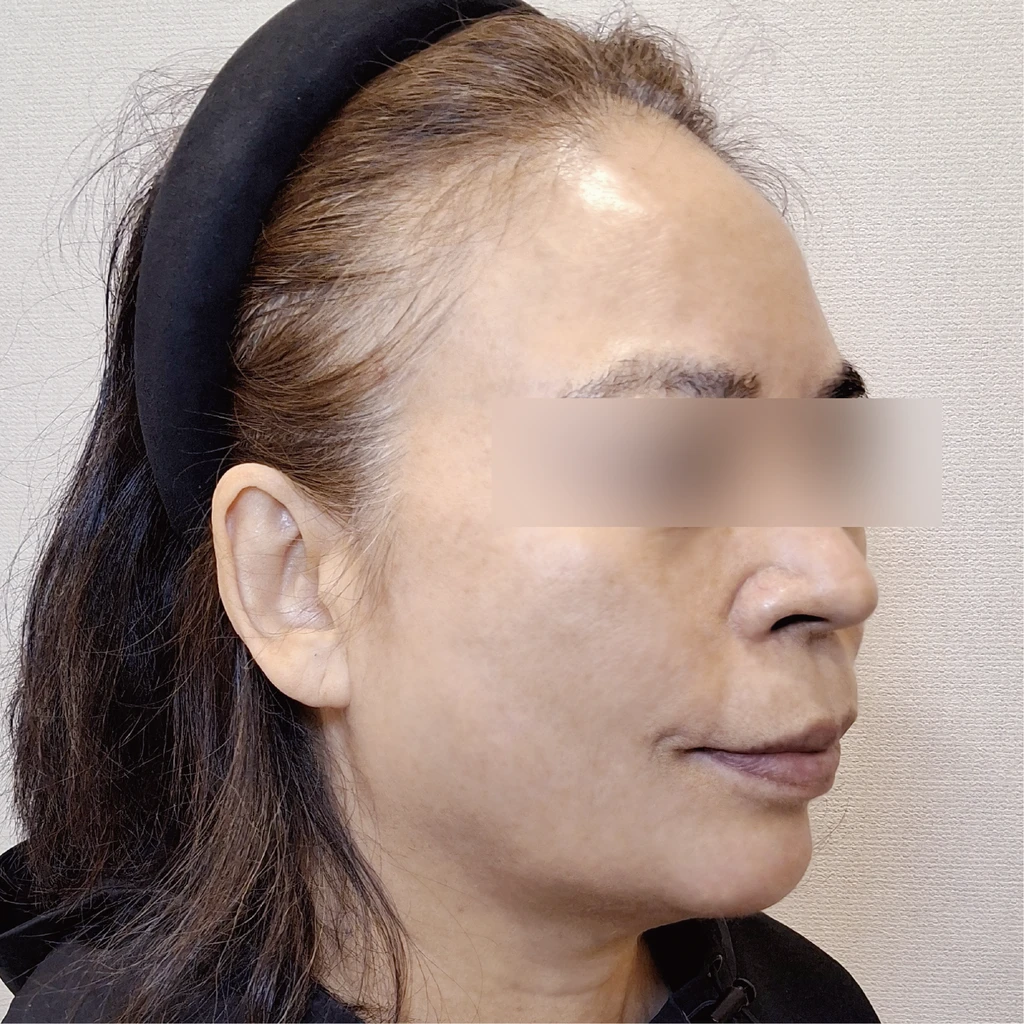 before_image