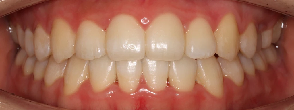 before_image