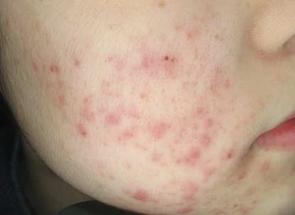 before_image