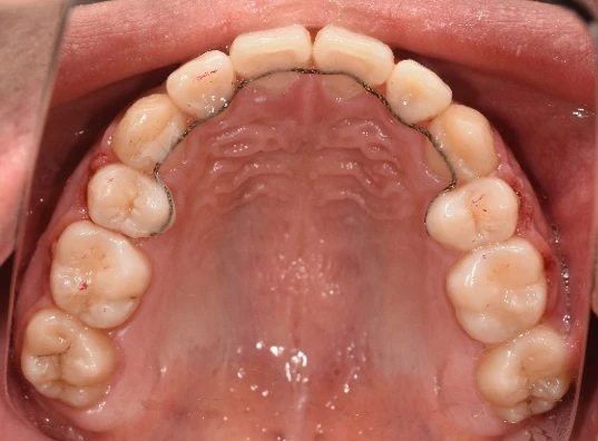 before_image