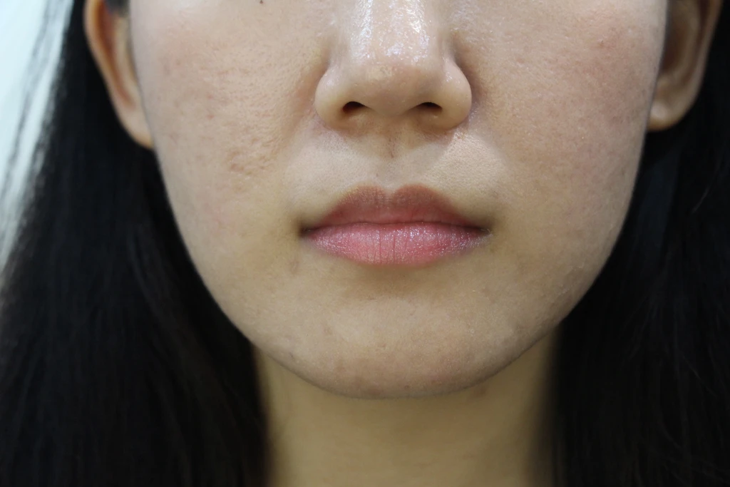 before_image
