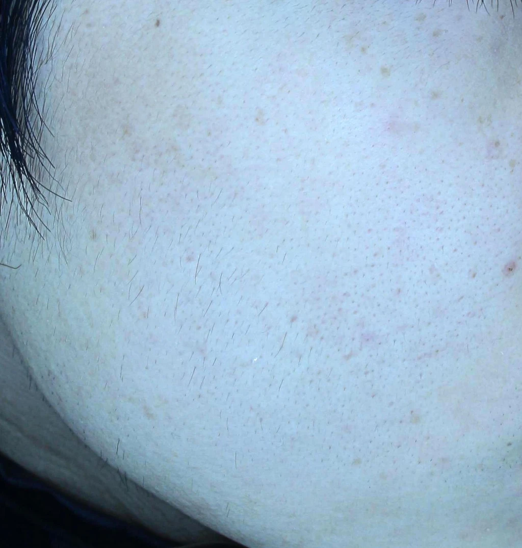 before_image