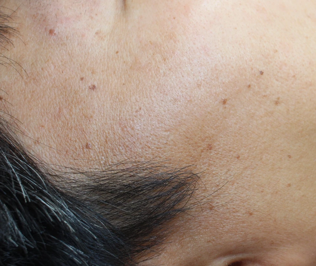 before_image
