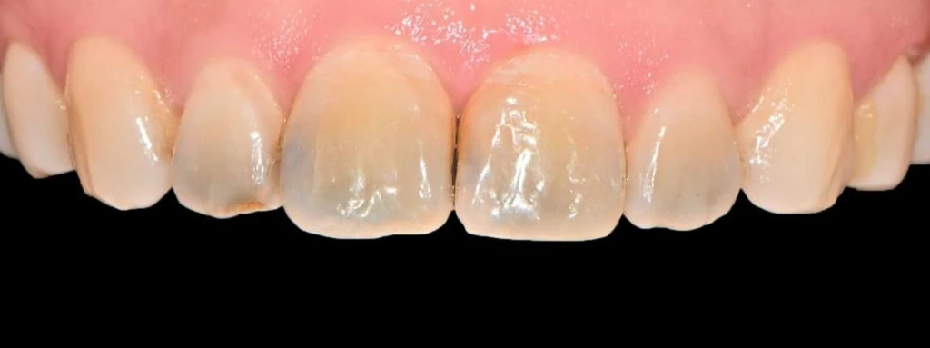 before_image