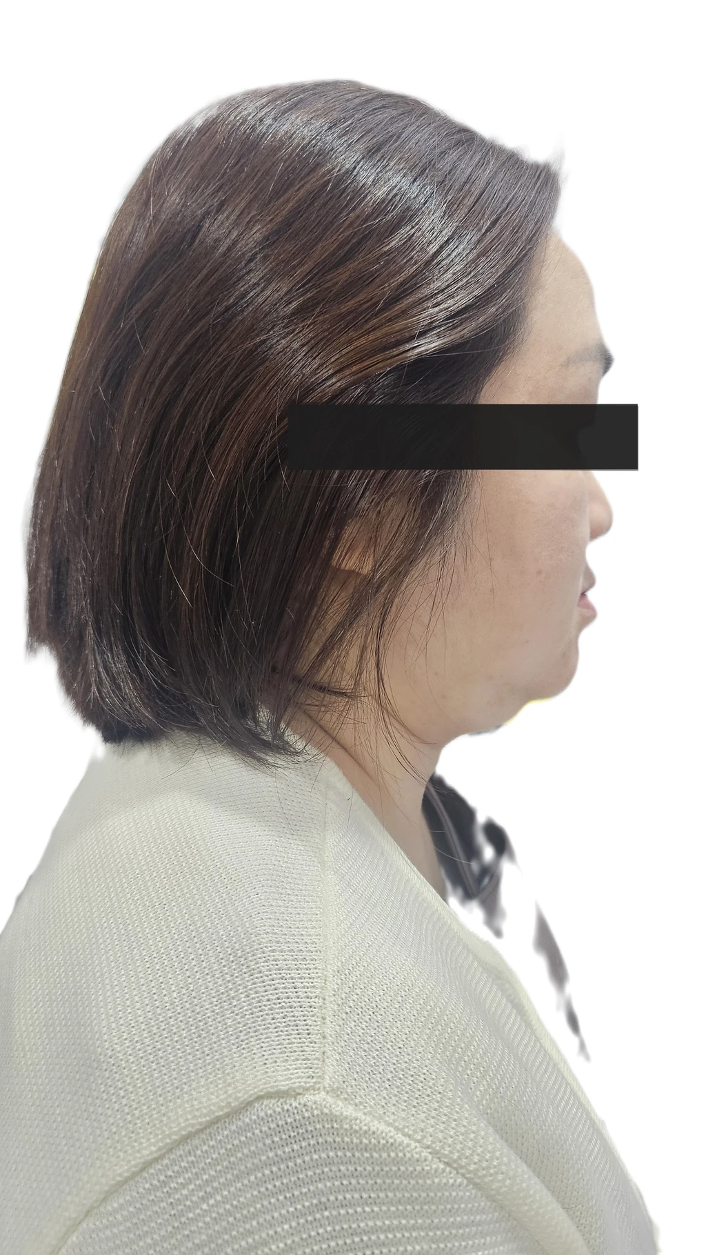 before_image