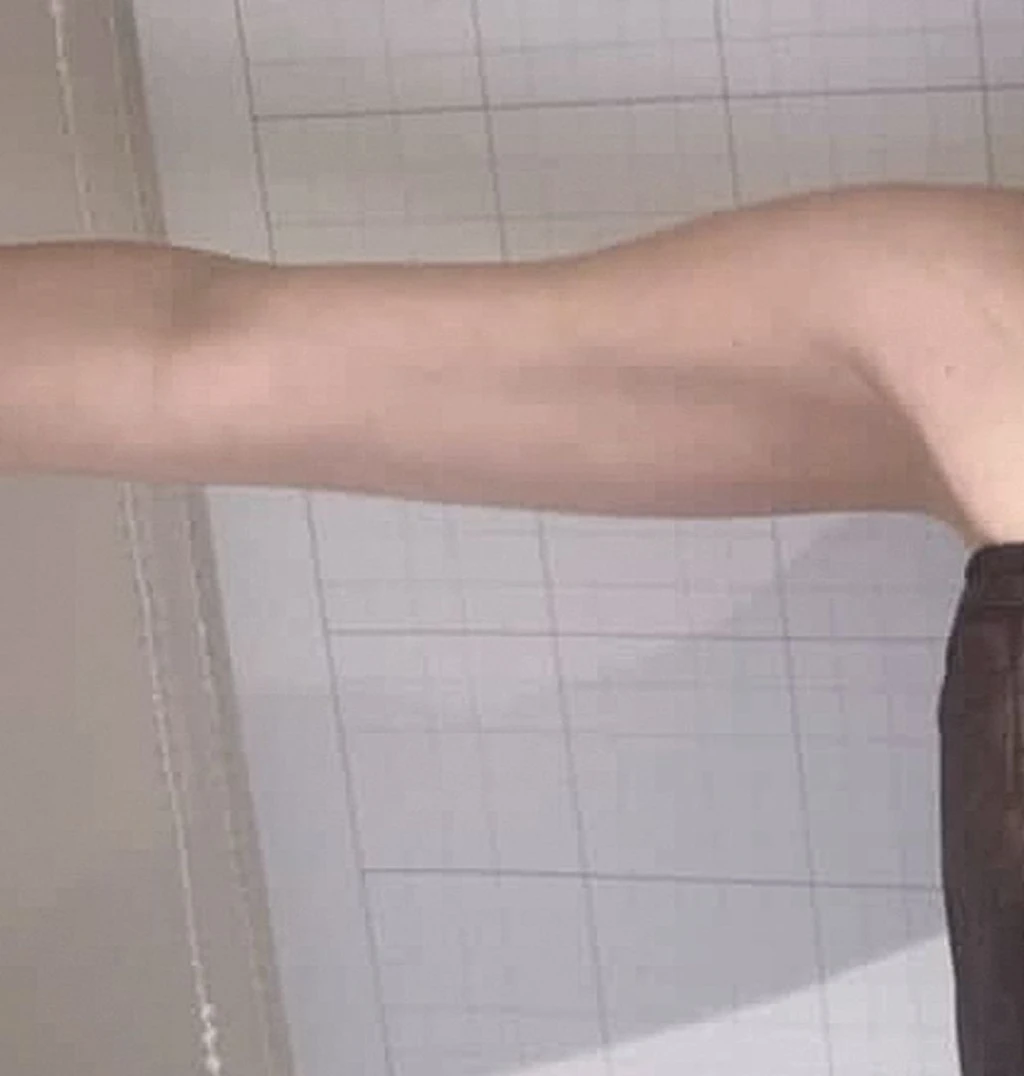 before_image
