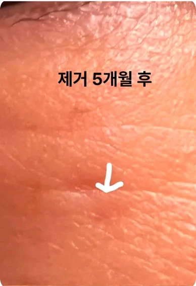 before_image