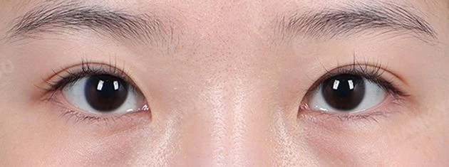 before_image