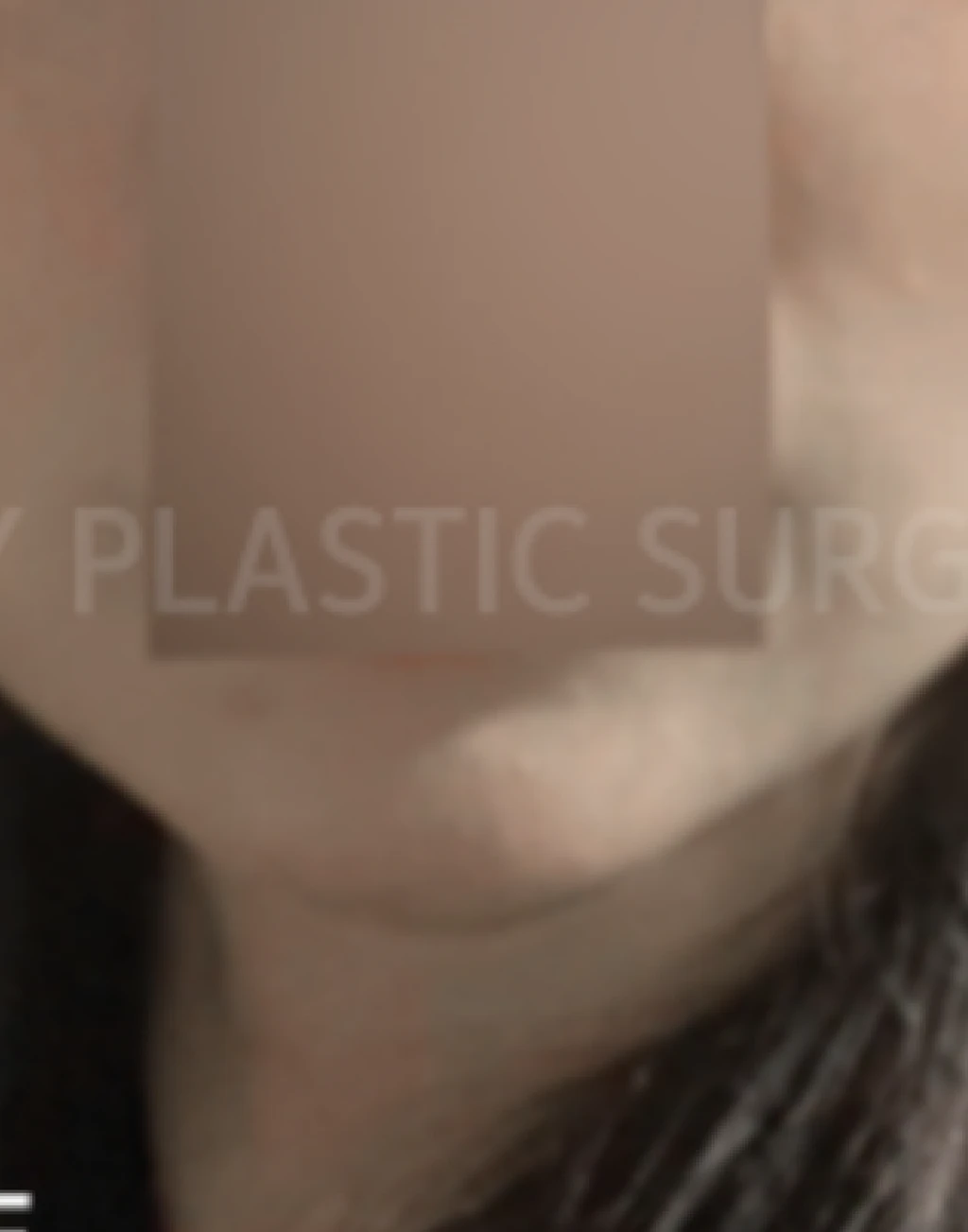 before_image