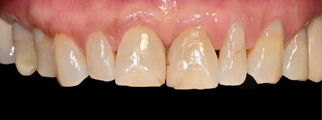 before_image