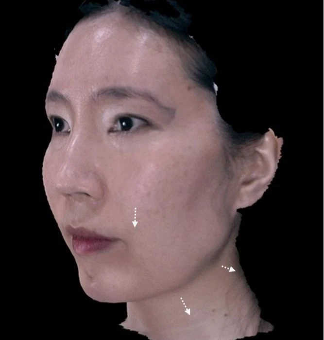 before_image