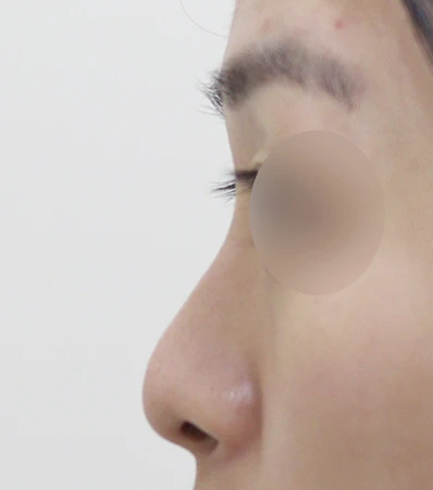 before_image