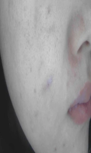 before_image