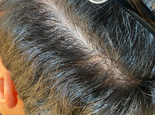 before_image