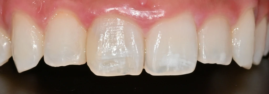 before_image