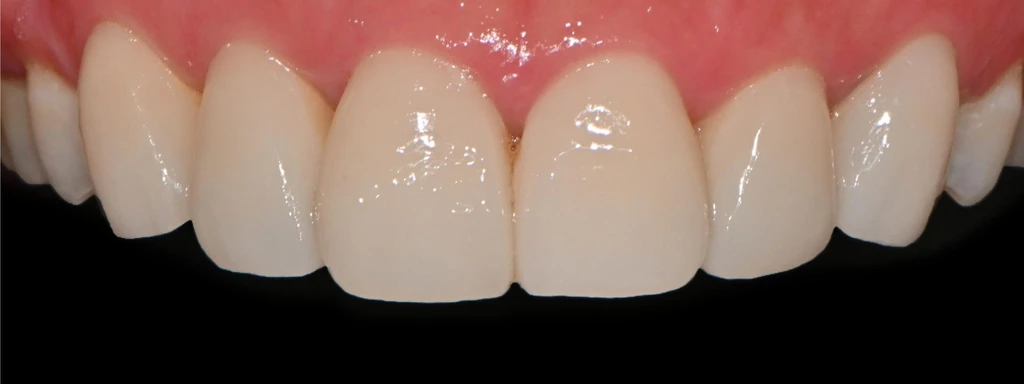 before_image