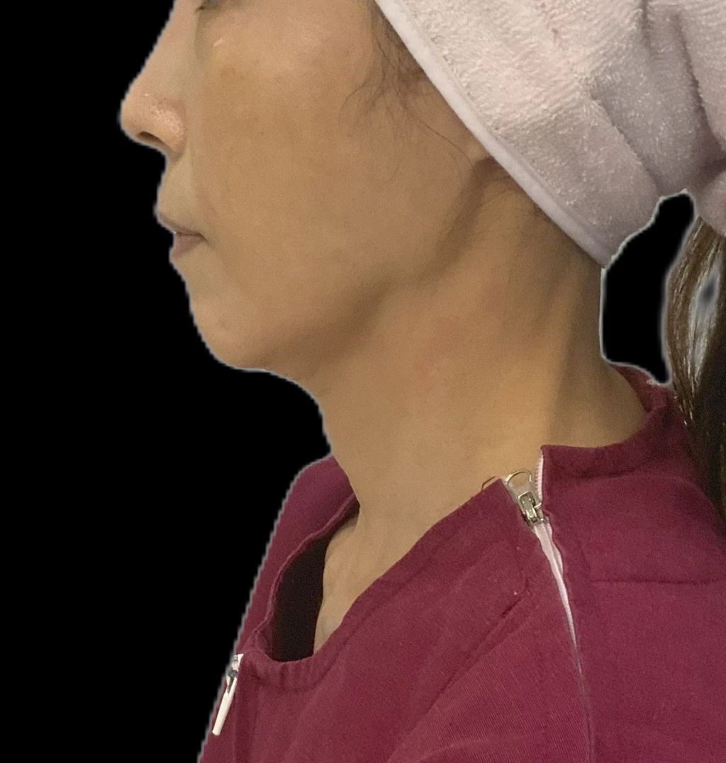 before_image
