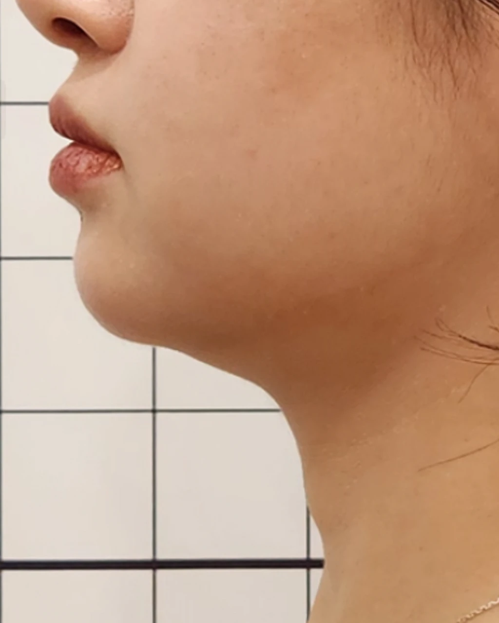 before_image