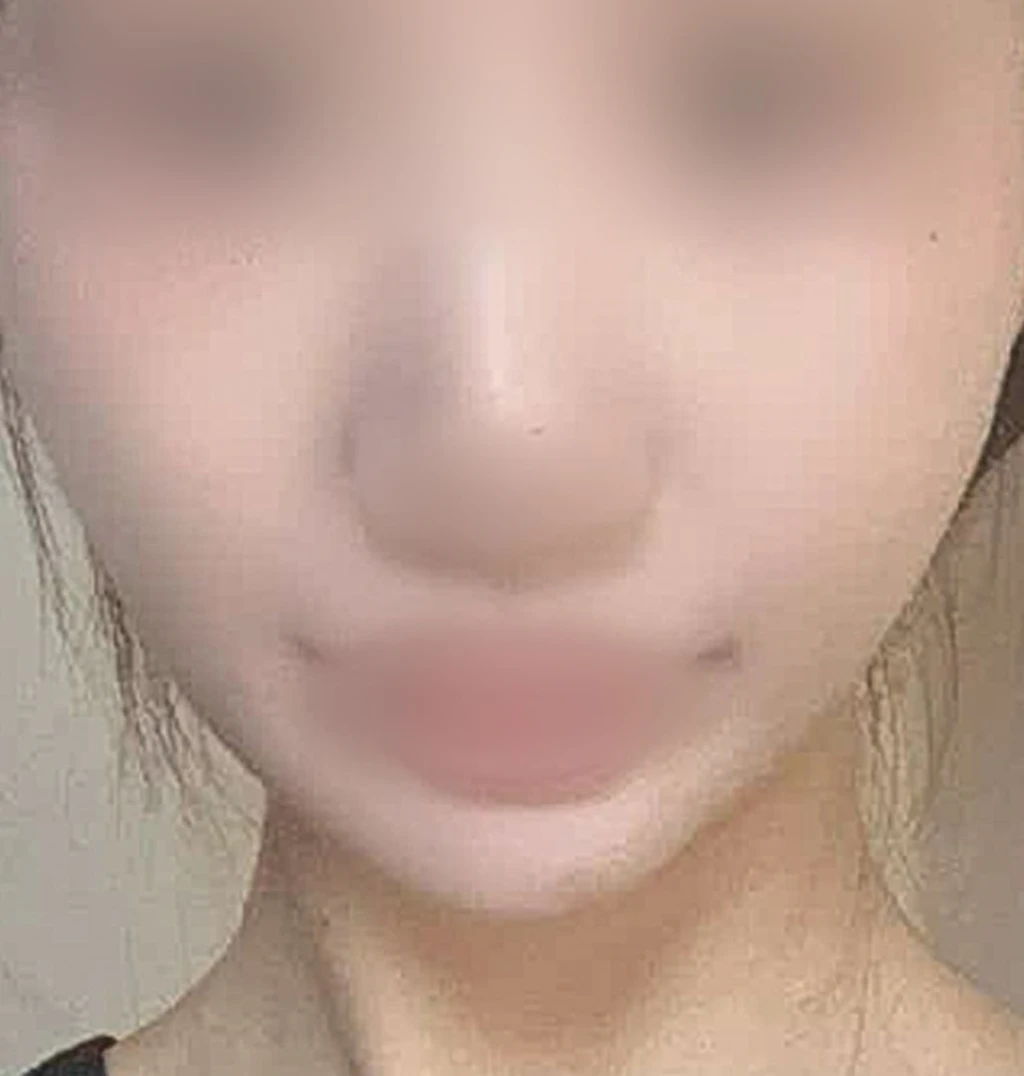 before_image