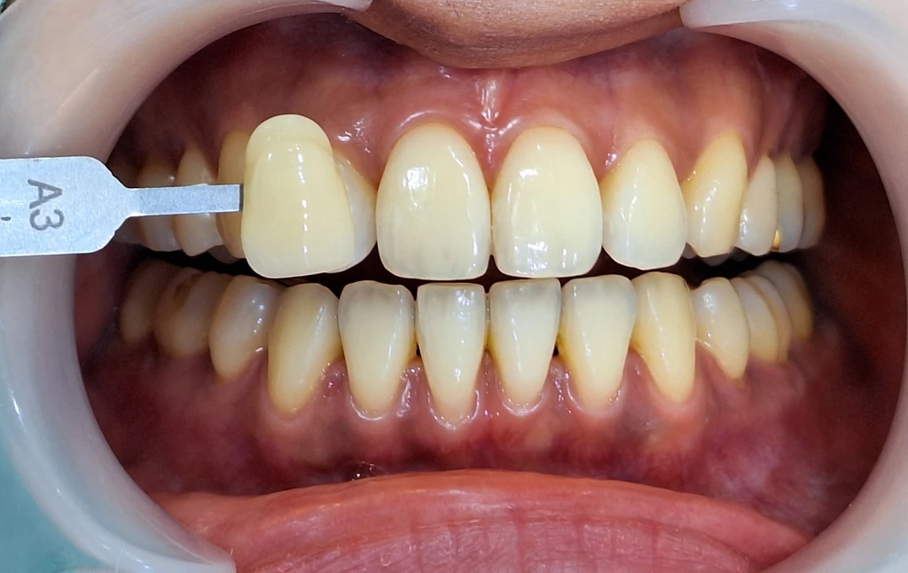 before_image