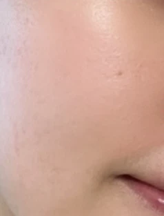 before_image