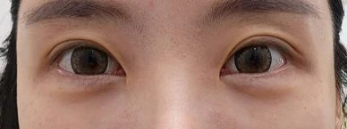 before_image