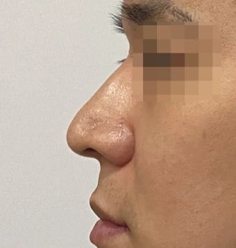 before_image