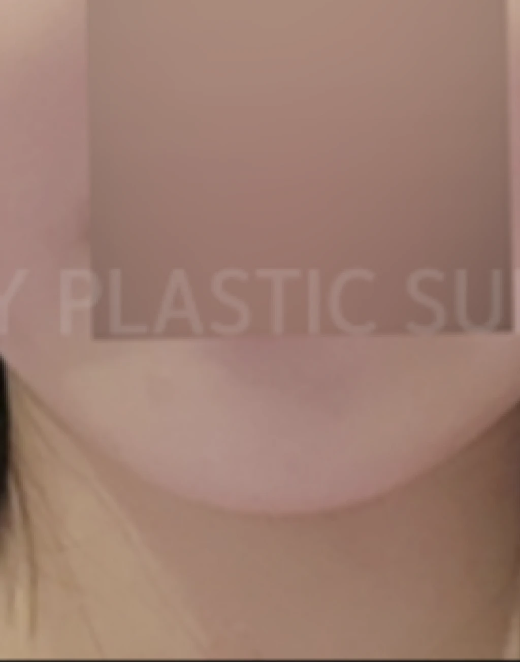 before_image