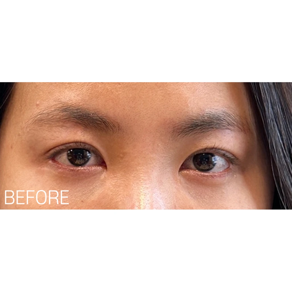 before_image
