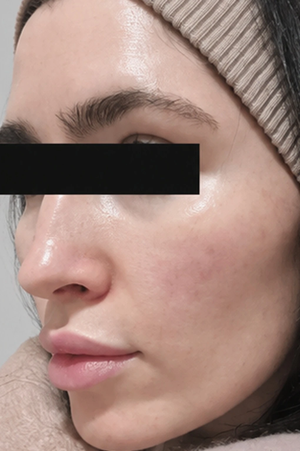 before_image