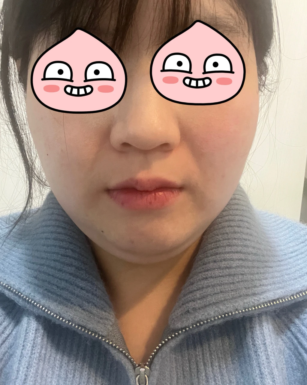 before_image