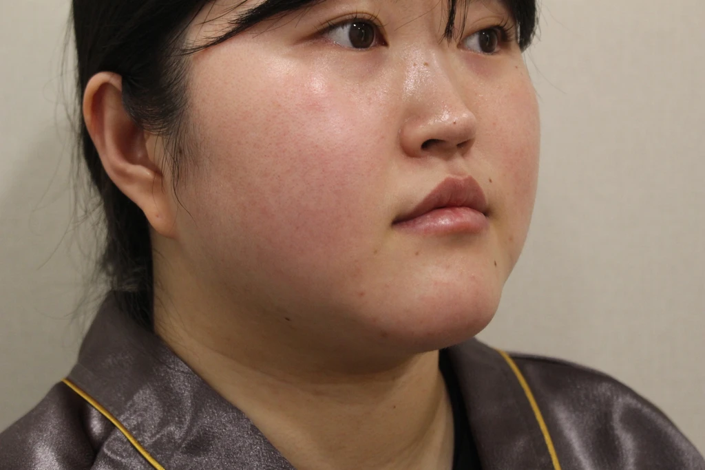 before_image