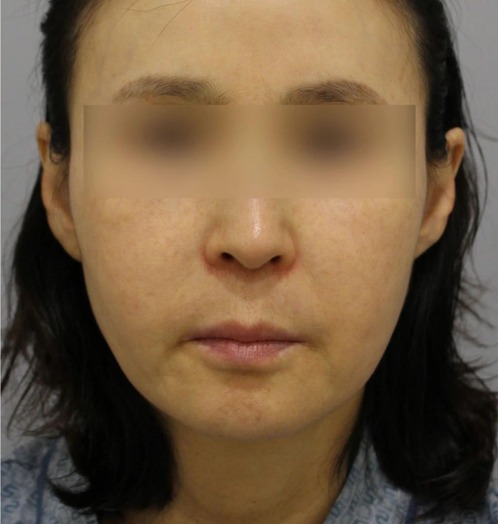 before_image