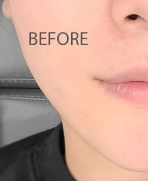 before_image