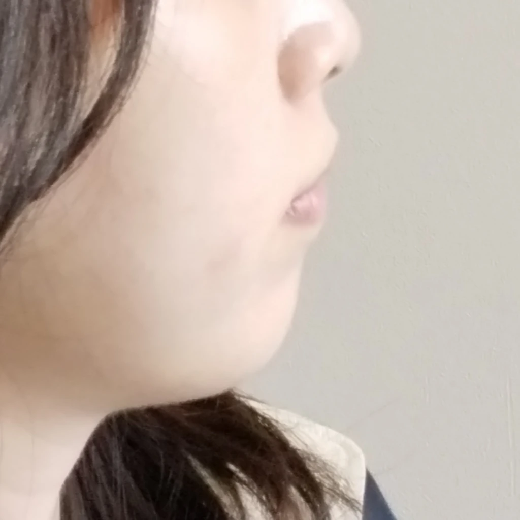 before_image