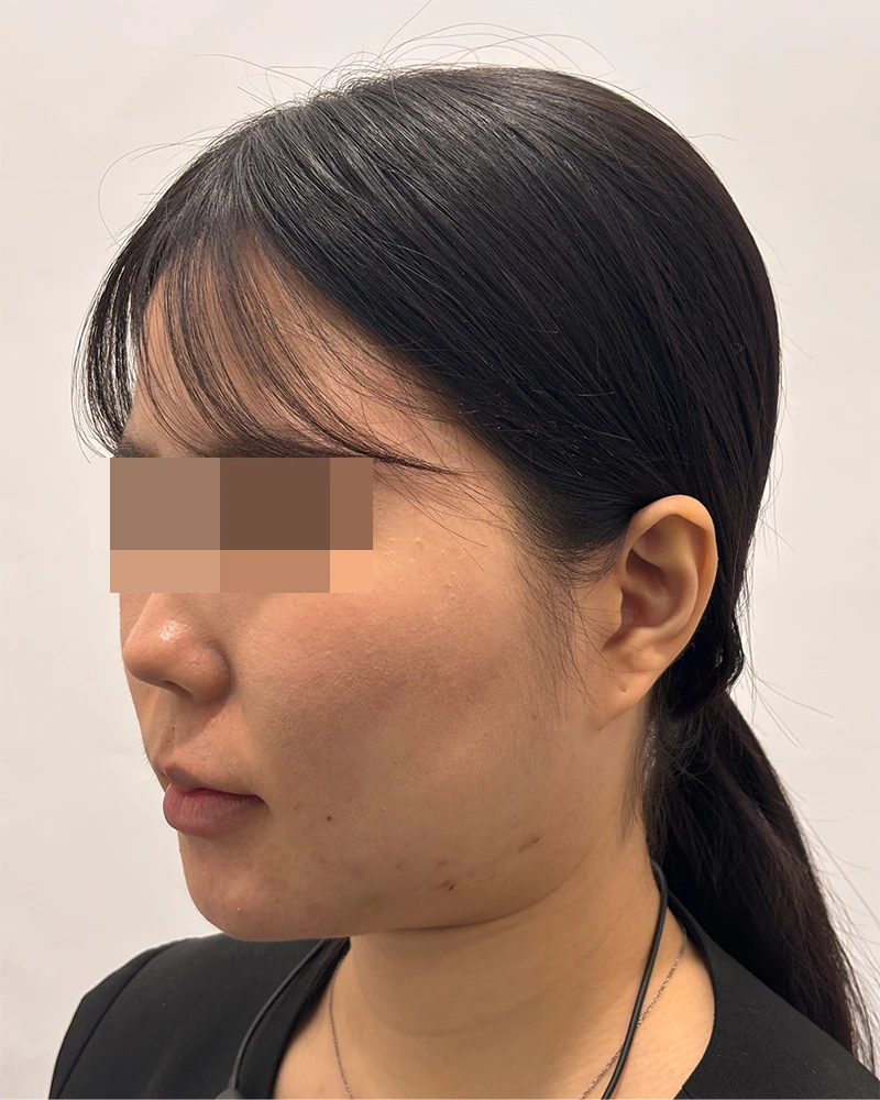 before_image