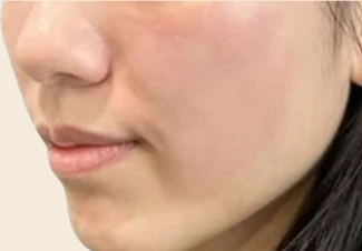 before_image