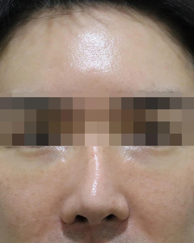 before_image