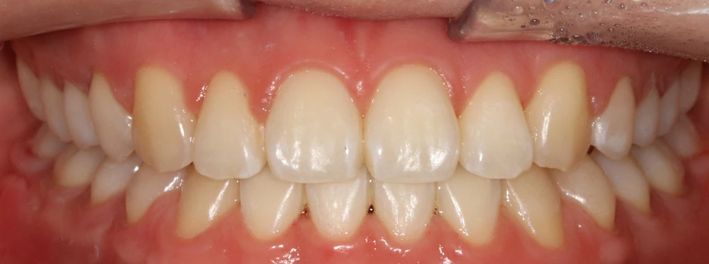 before_image