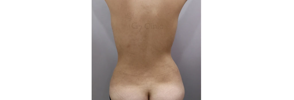before_image