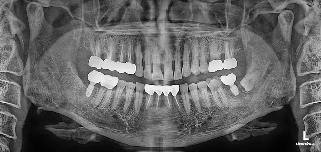 before_image