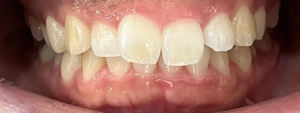 before_image