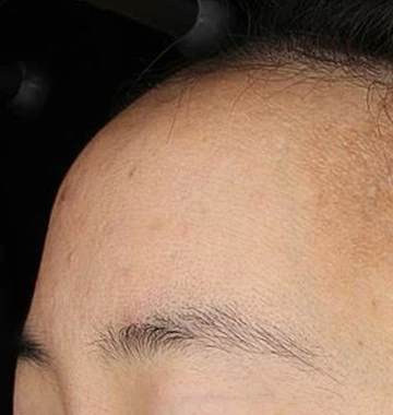 before_image