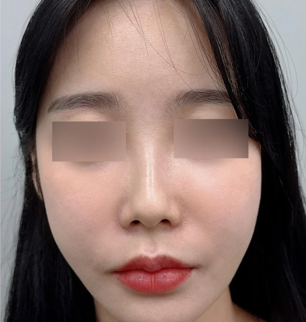 before_image