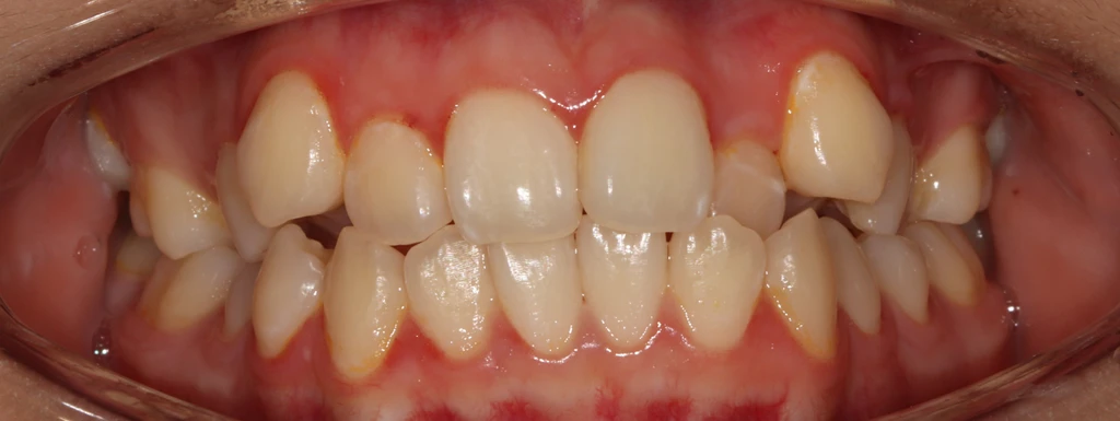 before_image