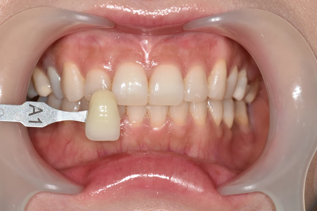 before_image