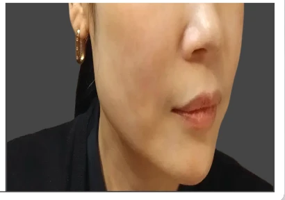 before_image
