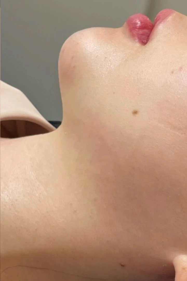 before_image