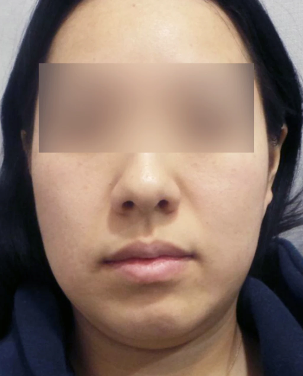 before_image